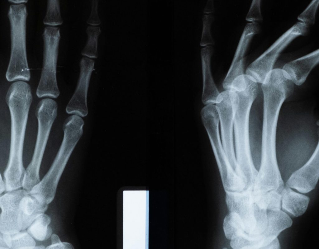 pexels-cottonbro-5723882